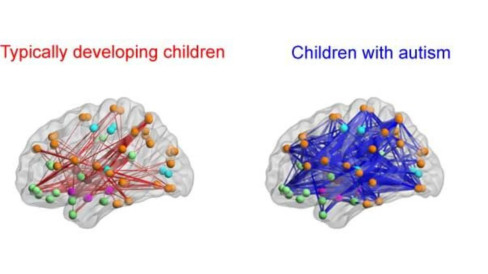 normal-wiring-compared-autistic-wiring.webp