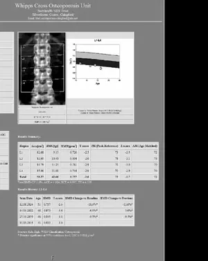 bone.webp