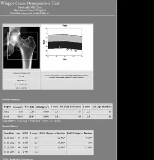bone2.webp