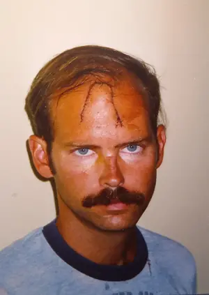 scar.webp