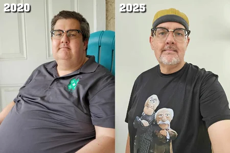 Sean before and after 20 vs 25.webp