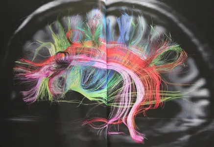 Found - the disconnected wire in my brain