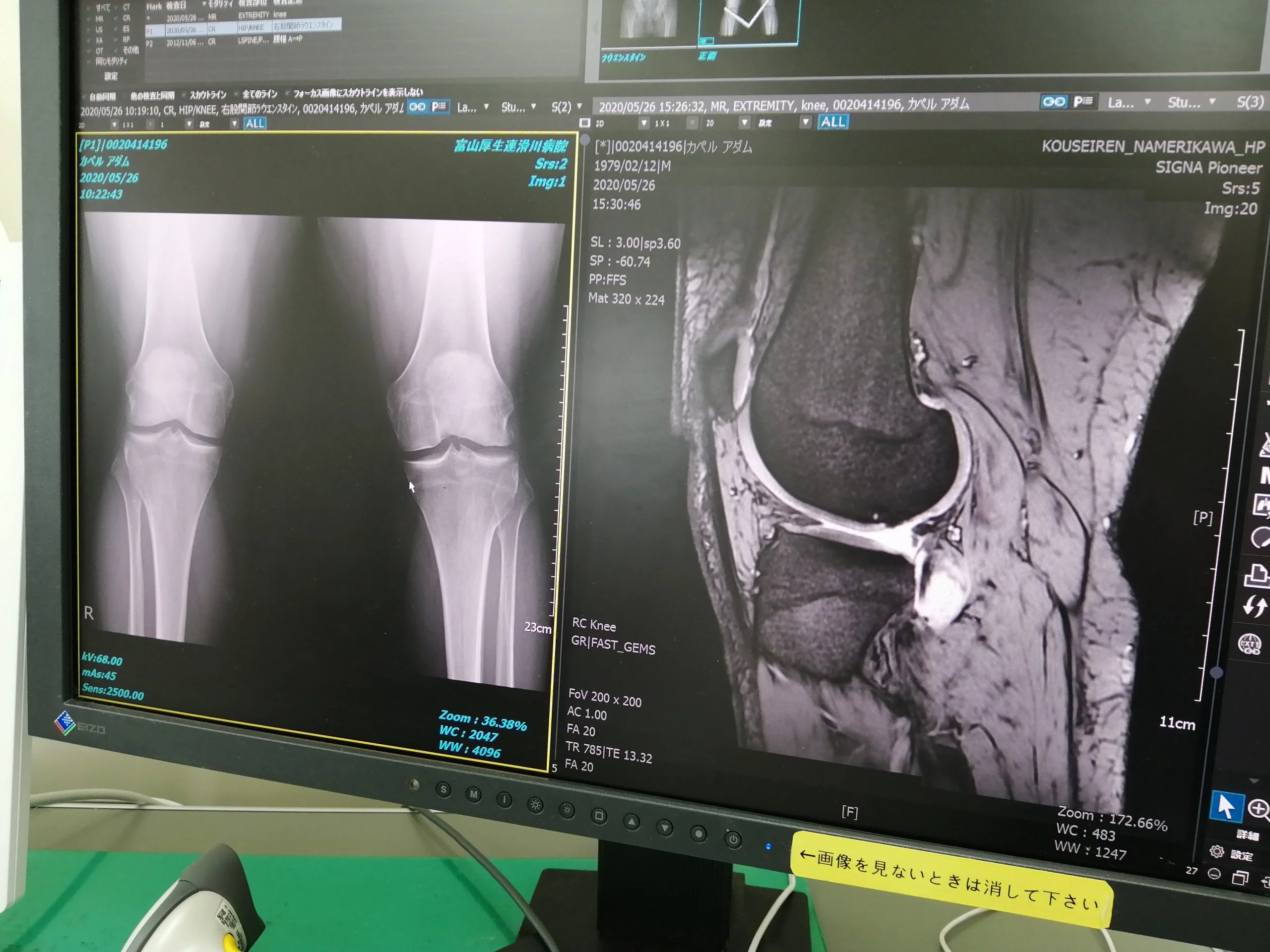 Knee MRI and x-rays