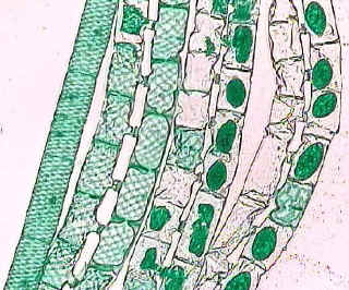 spirogyra_conjugating_small.jpg