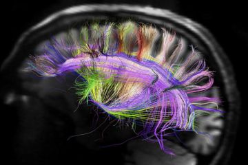 brain_fibers.jpg