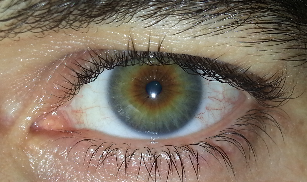 Hazel_eye1.png